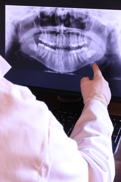 Emergency Dental Filling Replacement in OR